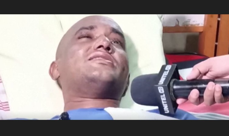 Acosta, the man who survived in the Amazon jungle by eating worms and insects.