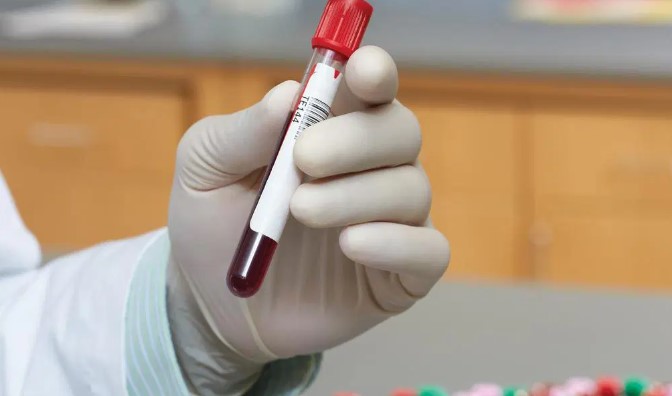 Hand in sterile glove holds up a blood-filled covered test tube.