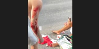 Bleeding pedestrians, one standing and one sitting on the ground, after a vehicle hit them at Rodney Bay.