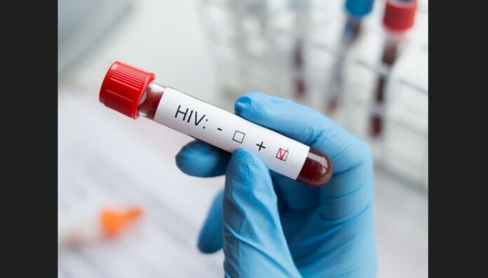 HIV Test Hand in blue latex glove holds up a test tube with blood with a label indicating that the sample is HIV positive.