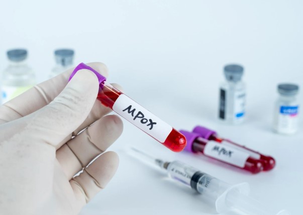 Blood in test tube marked 'Mpox'.