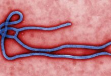 Saint Lucia updates Ebola preparedness plan as Caribbean strengthens border screening