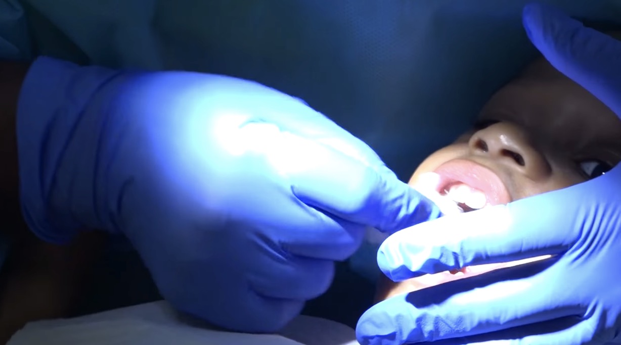 Mobile dental bus brings oral health services to children