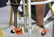 Prosthetic Centre gives amputees hope to walk again