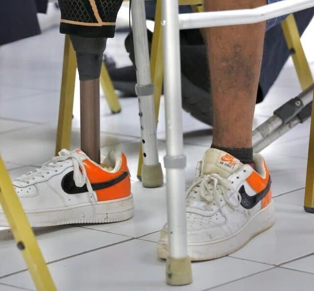 Prosthetic Centre gives amputees hope to walk again